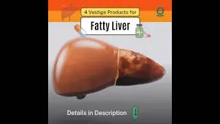 🌿 Vestige Products for Fatty Liver Disease | Natural Support for a Healthy Liver | #shorts #vestige