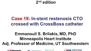Case 19: Manual of CTO Interventions - CrossBoss for in-stent CTO