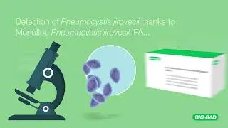 Mycology Range – Bio-Rad’s fungal infection detection assays