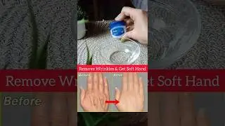 💥Remove Wrinkles & Get Soft Hands#skincare #wrinkles#skincaretips#glowingskin#skincareroutine#shorts