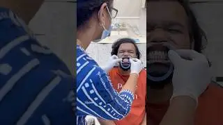 🔥kastama eruku💯😥Invisalign journey husband vs wife  #comedy #funny #short #shorts #ytshorts #fun