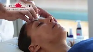 White Lotus Ventouses Chinoises Cupping Th&eacute;rapie pour Visage et Corps