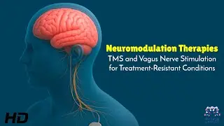 Neuromodulation Therapies : TMS and Vagus Nerve Stimulation for Treatment-Resistant Conditions