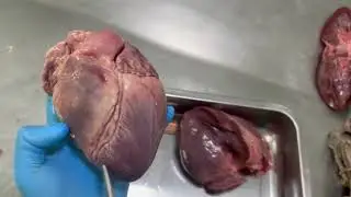ANATOM&Iacute;A DEL CORAZ&Oacute;N ❤️ - DOCTOR RO