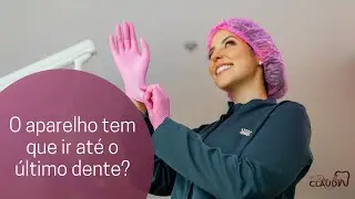 O aparelho tem que ir até o último dente?