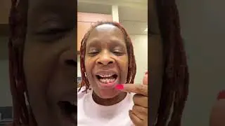 I am going to have to get partials dentures OMG #dentalreview