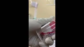 STOOL CULTURE PROCEDURE