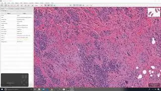 10 - View magnification