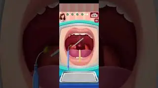 ASMR | Satisfaction Tonsils Removal Treatment- Point ASRM