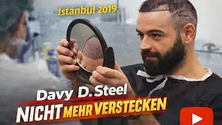 Davy D. Steel - Geheimratsecken ? Nicht mehr Verstecken (2019)