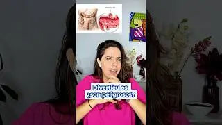 &iquest;Qu&eacute; son los #divert&iacute;culos , son peligrosos?👩🏼&zwj;⚕️ #diverticulitis #saluddigestiva #doctora