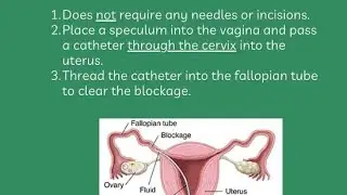 fallopian tubes recanalization (avoid IVF) with Dr misbah Tahir