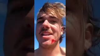 Marlin Bill To The Face