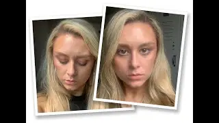Beauty blogger Gia Mazur's first Botox experience