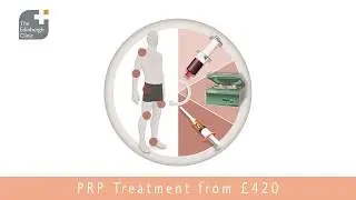 What is PRP (Platelet Rich Plasma)
