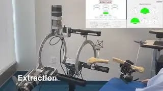 Robossis: Auto Alignment of the Fractured Femur