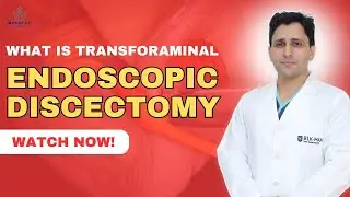 What Is Transforaminal Endoscopic Discectomy? | Minimally Invasive Spine Surgery Explained