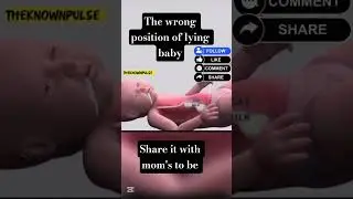 newborn's lying position and its effects #newbornbaby #viralshorts #firstcry@knowledge6016