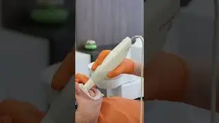 3SHAPE TRIOS  цифровийвнутрішньоротовий сканер з котрим працюють у стоматології Dentify на Печерську