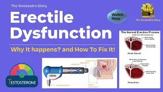 Erectile Dysfunction: Early Warning Sign You Should Not Ignore | Men's Health | The Docsaab&rsquo;s Diary