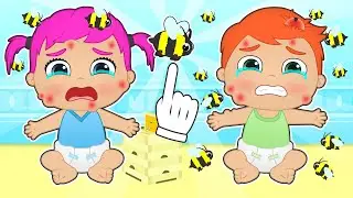 BEBÉS ALEX Y LILY 🐝🚑 Cómo curar las picaduras de abeja