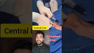 central line procedure