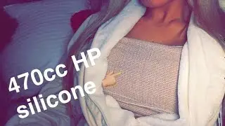 1 Week Post Op Breast Augmentation w/ Dr. Mosser | Avery