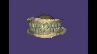 How to design in exocad for full mouth pmma prosthesis?