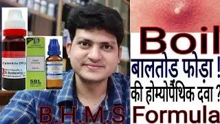 बालतोड़ ! फोड़ा ! Boil ! Homeopathic medicine for Boils ?? B.H.M.S FORMULA !