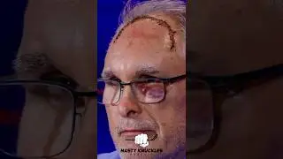 Что на самом деле случилось с головой Крейга Берубе?