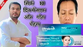 Ultra Bright Triple Action Cream Review 2024 | ultrabrite skin cream | triple action cream