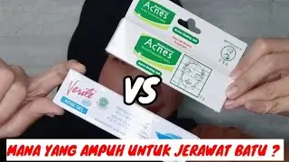 Battle Acnes Sealing Jell VS Verile Acne Gel || Gisti Prilastri