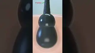 Hair fall sirf oil se nahi rukta! | Hair Problems | #bharatlab #healthcheckup #hairproblem