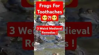 3 Bizarre Medieval Medical Treatments! ⚕️🩸✨ #medieval #history #funfacts #facts #shorts