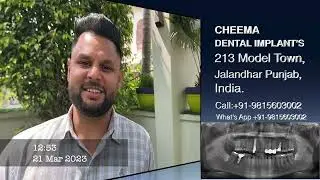 front teeth gap dental implants molar in jalandhar punjab india review cheema dentist model town