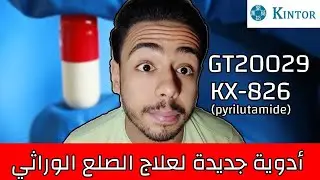أدوية جديدة هتنسف الصلع الوراثي