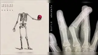 Bones x abcdefu (mashup) - Imagine Dragons + GAYLE