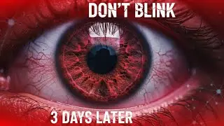 What If You Never Blinked Again? (It&rsquo;s Terrifying)