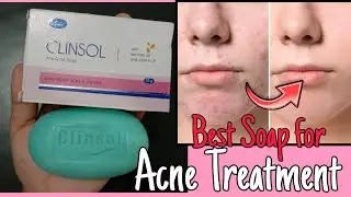 Мыло CLINSOL | Мыло против акне | Лучшее мыло от прыщей и угрей | Обзор и преимущества