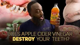 Does Apple Cider Vinegar destroy your TEETH?