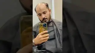 Anas Sheikh Hair Solution | Short Video Hair Patch | Hair Patch For Men | Call us 9650914665