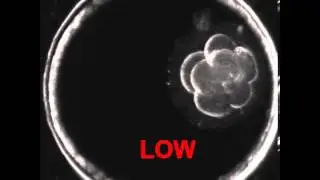 Example of Eeva Low Video with Ellipses