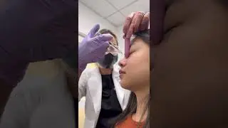 Nose & Chin Filler Before & After: Incredible Transformation
