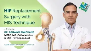 HIP REPLACEMENT SURGERY IN INDIA BY MIS TECHNIQUES  - DR ASHWANI MAICHANDA