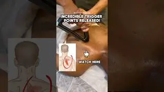 Watch that trigger points released!! #rhomboids #backpain #physicaltherapy