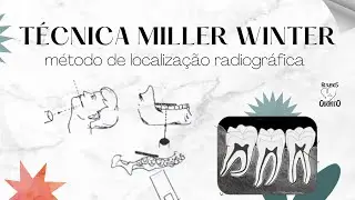MÉTODO DE LOCALIZAÇÃO MILLER WINTER | RESUMOS DE ODONTO