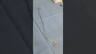 Ureteral Stent Removal part 3 of 3