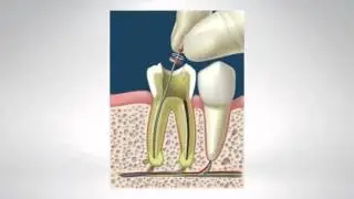 Teeth Whitening in Jackson TN | Dental Associates, Inc.