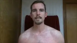 The Best Probiotics To Cure Psoriasis Naturally | Plant & Soil Based Organisms | Prebiotics