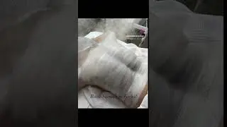 Signature Back Facial # backfacial